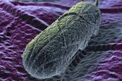 We are what we eat but are microbes also indicative of where we’ve been?