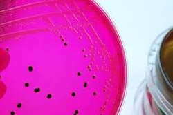 Ideally, validation of targeted process control points can be simulated in a laboratory setting so appropriate Salmonella strains could be used for the evaluation.