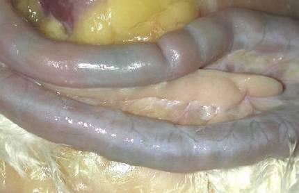 Duodenal loop of a hen affected with fdn showing darkened areas which are visible through the serosa.