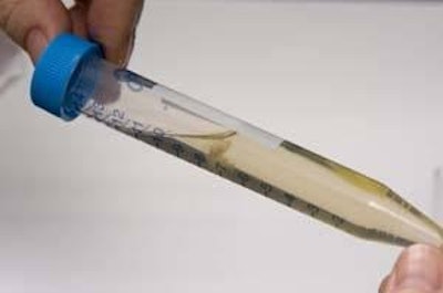 Changing just one nucleotide in the DNA sequence can code for a different amino acid in a protein molecule, which can lead to a different function or structure for the protein. Photo courtesy Hy-Line