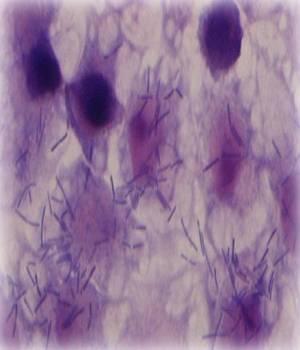 Lactobacillus johnsonii. Lactobacillus spp. aislado del intestino del pollo presenta efectos inhibitorios sobre el crecimiento de las bacterias patógenas. (Foto cortesía de: Institute of Food Research, UK. )