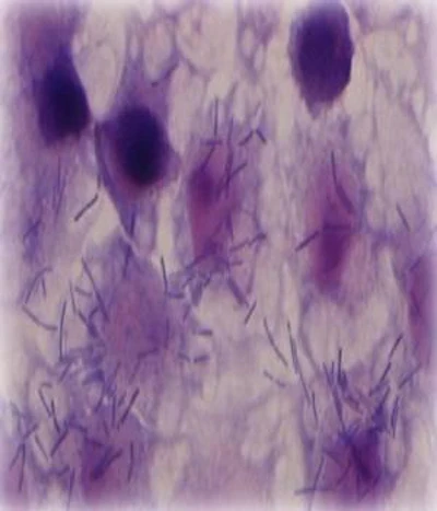 Lactobacillus johnsonii. Lactobacillus spp. aislado del intestino del pollo presenta efectos inhibitorios sobre el crecimiento de las bacterias patógenas. (Foto cortesía de: Institute of Food Research, UK. )