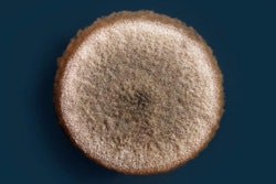 Aspergillus niger colony on an agar plate | Pelooyen | BigStockPhoto