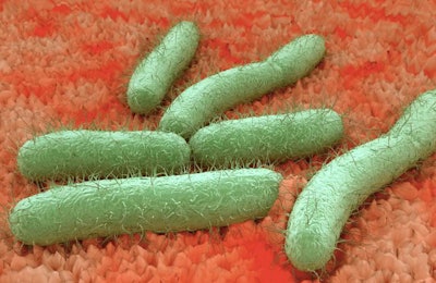 auntspray | BigStockPhoto