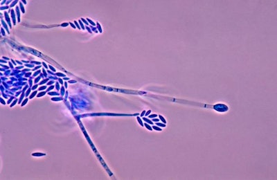 Fusarium_mycotoxin_Wikimedia-Commons