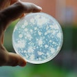 bacteria culture growing on agar plate