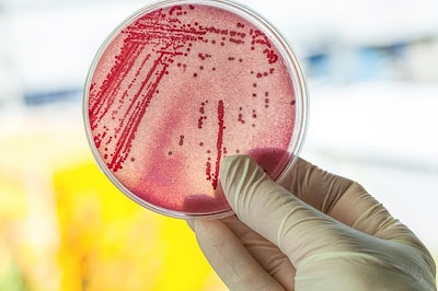 Approximately four out of every five instances of Campylobacter in people results from handling and eating contaminated chicken meat. (Katarzyna Bialasiewicz | Dreamstime.com)