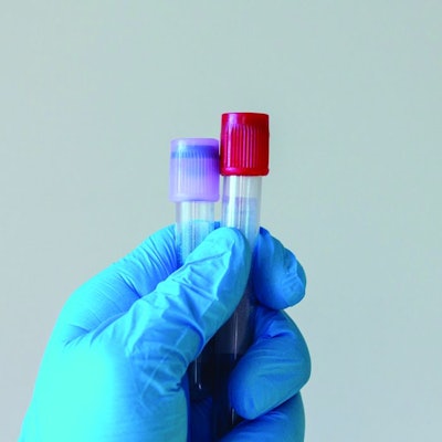 Gloved Hand Holding Test Tube