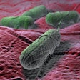 The proposed Salmonella framework for raw poultry products would classify some Salmonella serotypes as adulterants if found on ready-to-cook chicken products and ground turkey.