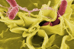 Salmonella Bacteria Pixbay com