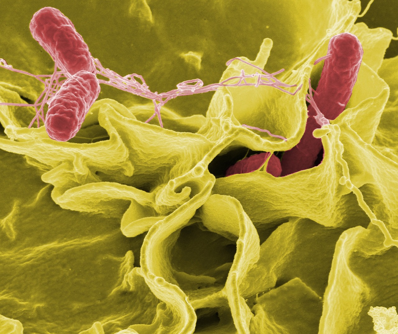 Salmonella Bacteria Pixbay com