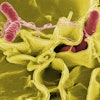 Salmonella Bacteria Pixbay com