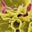 Salmonella Bacteria Pixbay com