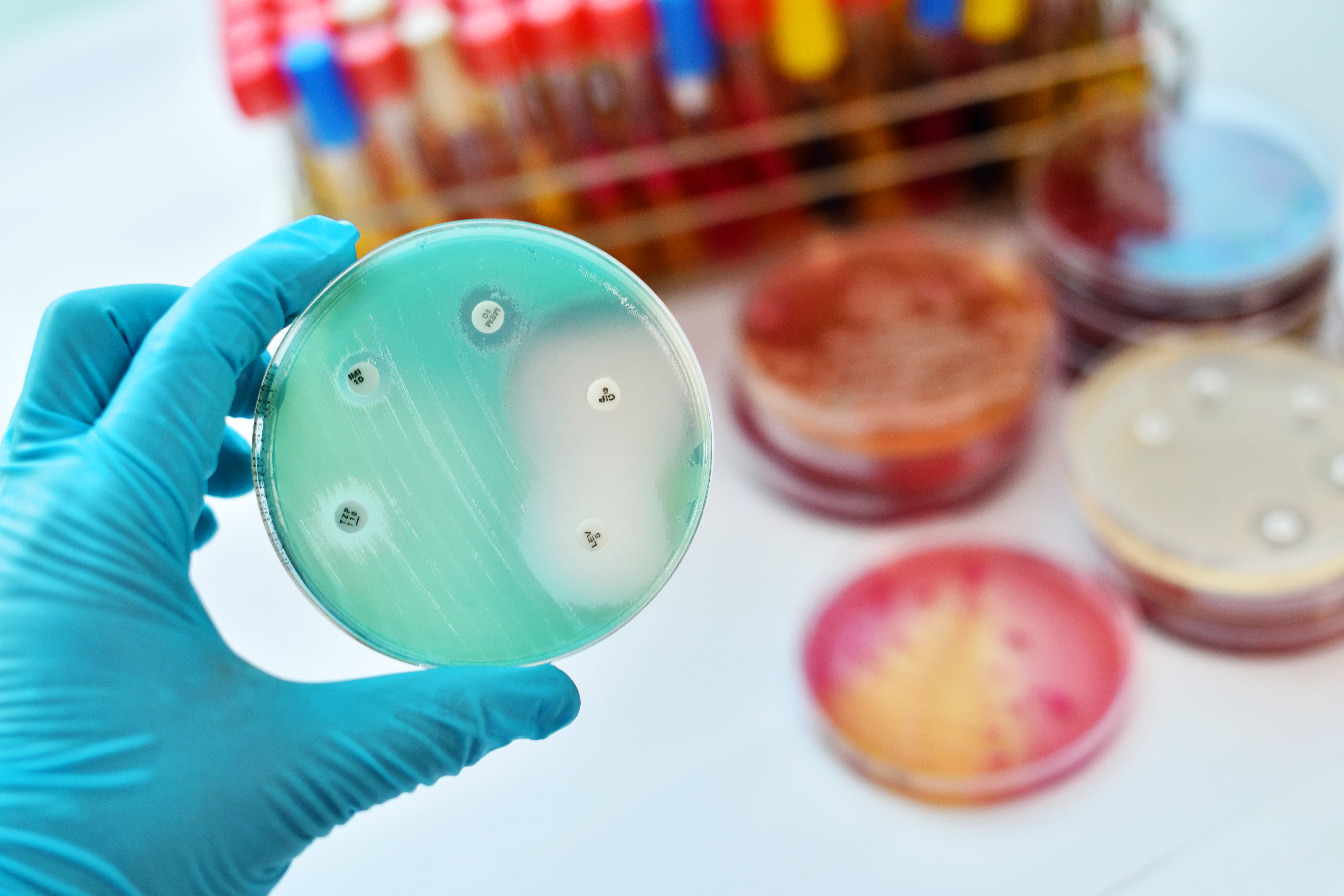 Antimicrobial Petri Dish