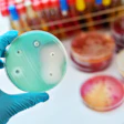 Antimicrobial Petri Dish